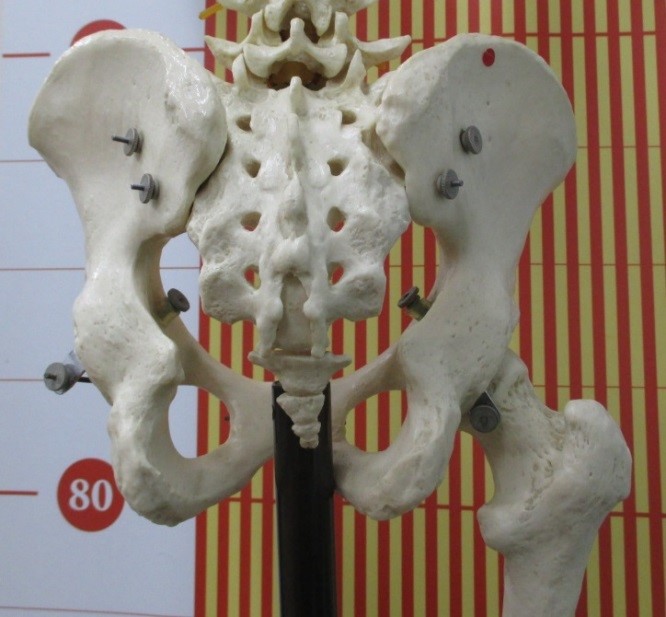 股関節の骨模型